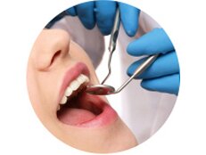 详细的口腔检查